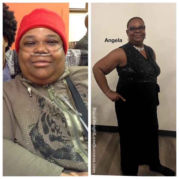 Angela lost 93 pounds - Black Weight Loss Success