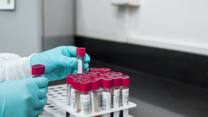 How soon can HIV be detected by a blood test?