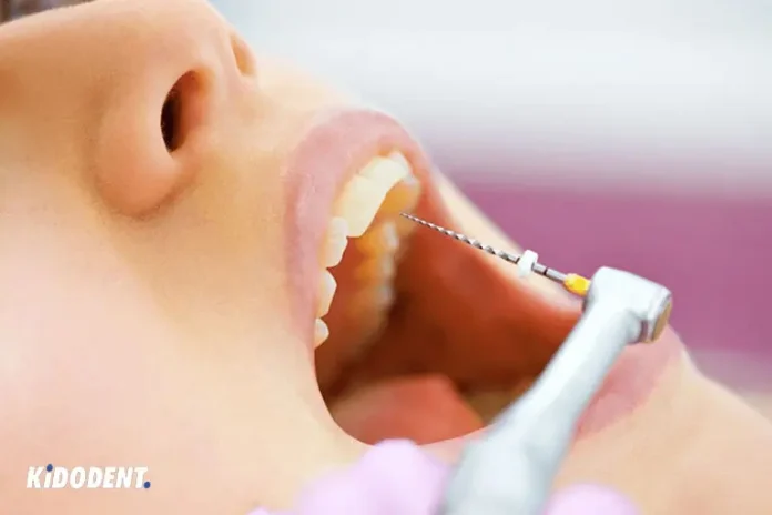 Root Canal on Front Tooth: Procedure, Benefits, and More