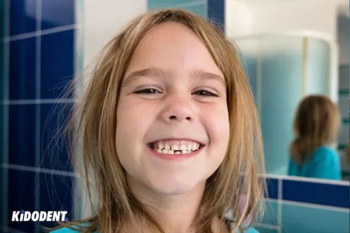 What to Do If Your Child Chipped a Tooth?