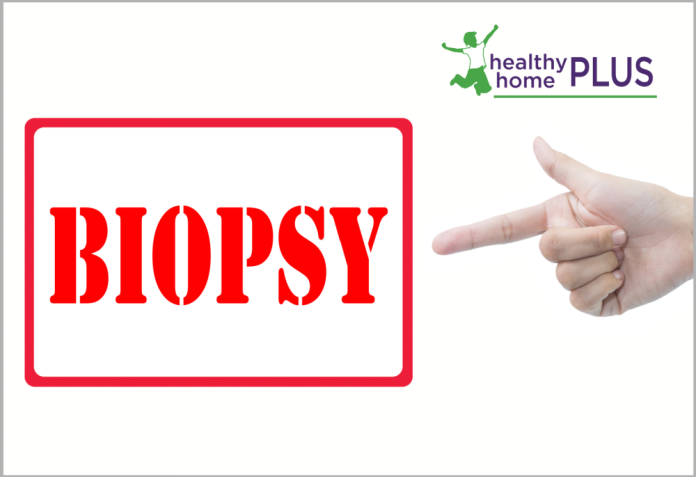 How to Protect Yourself from the Cancer Biopsy Racket