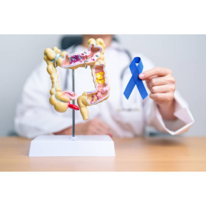Weirdest mouth signs that predict colon cancer