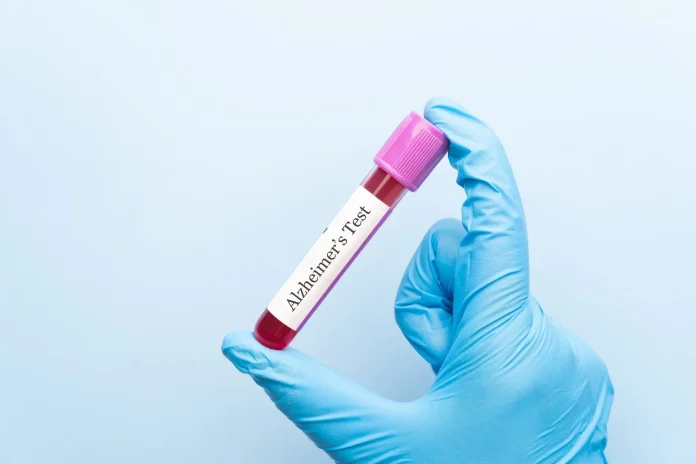 Identifying the ages when Alzheimer’s biomarkers sharply change