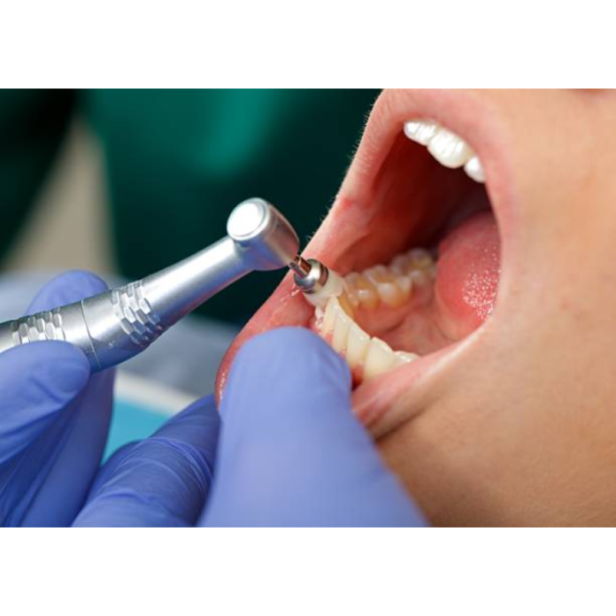 A dentist's must-haves for keeping teeth white between cleaning
